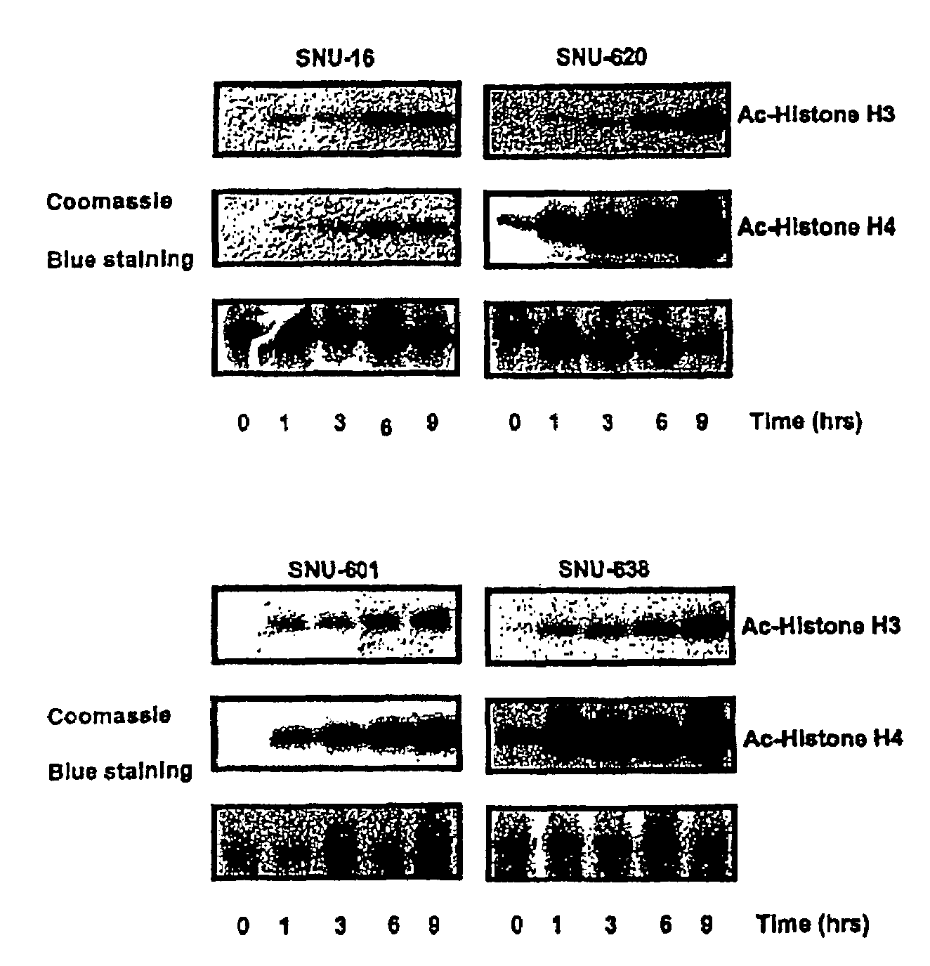 Alpha,beta-unsaturated hydroxamic acid derivatives and their use as histone deacetylase inhibitors