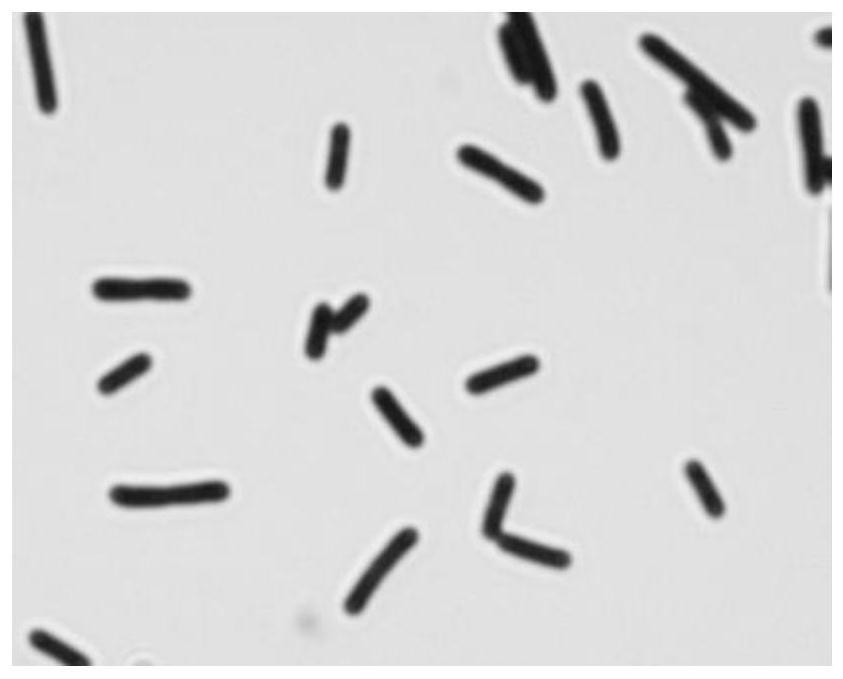 A kind of Lactobacillus fermentum for preventing and treating hyperuricemia and its composition and application