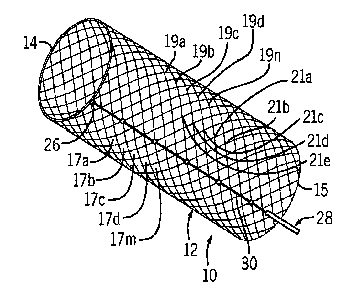 Mechanically adjustable variable diameter stent