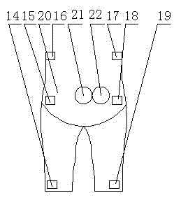 Manufacture method of detachable neonatal enterostomy nursing pants