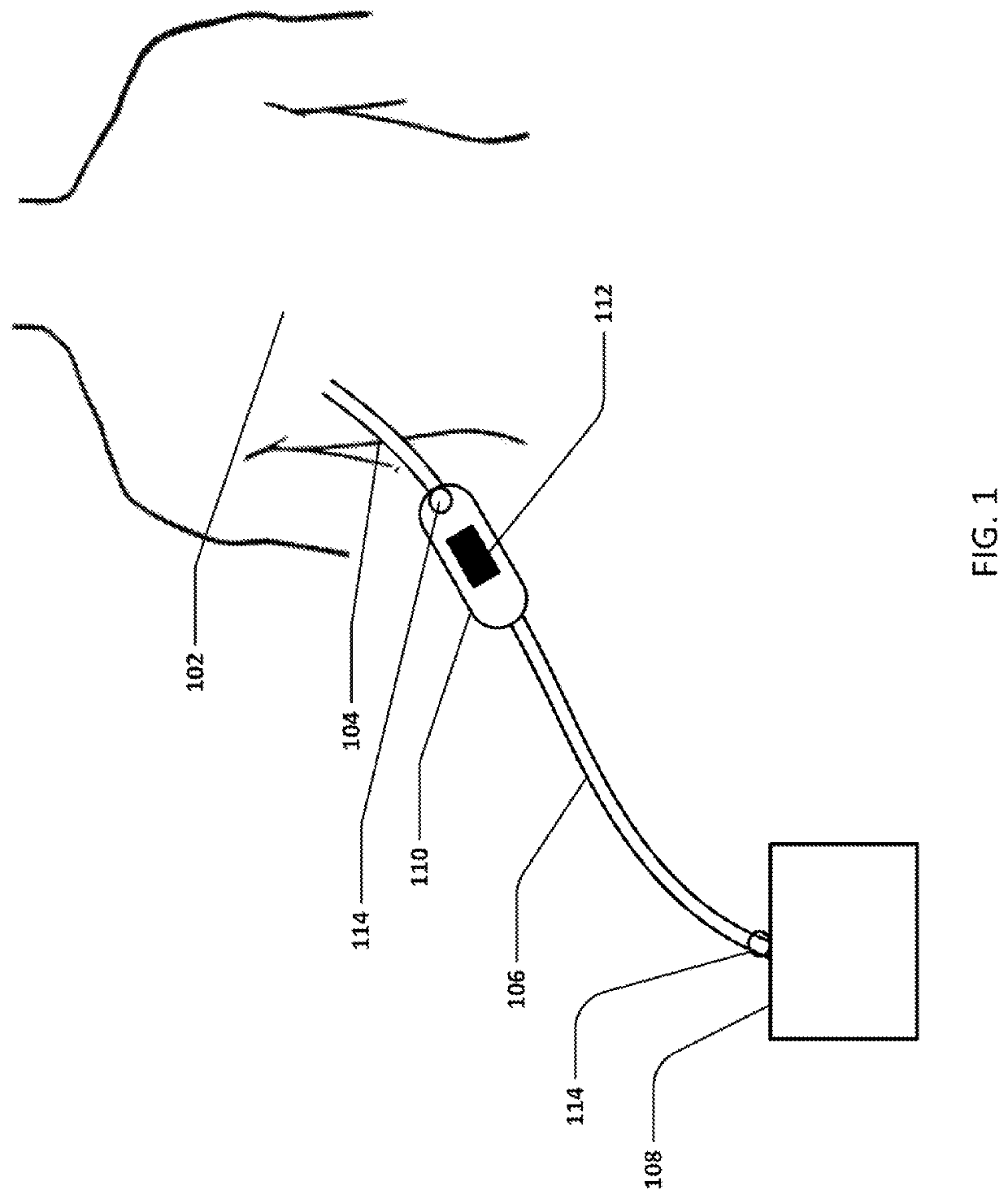 Devices and methods for managing chest drainage