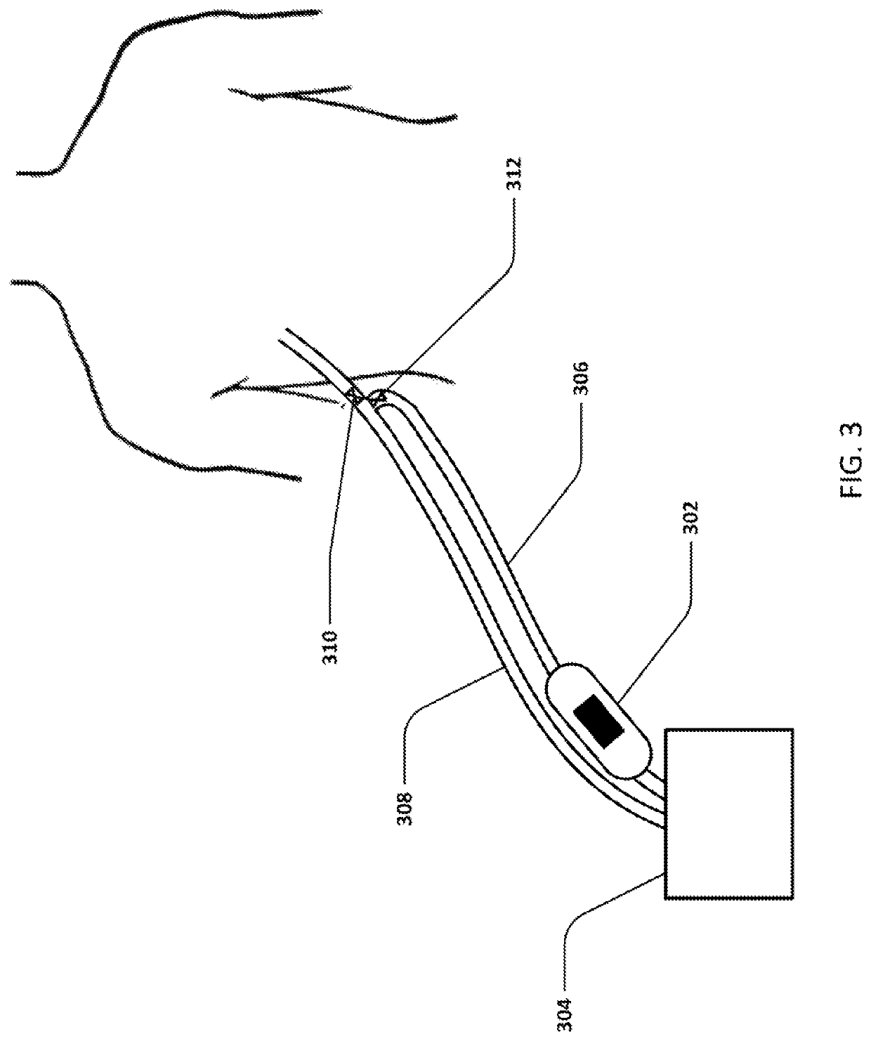 Devices and methods for managing chest drainage