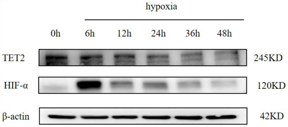 Application of TET2 as target in treatment of ischemic vascular diseases