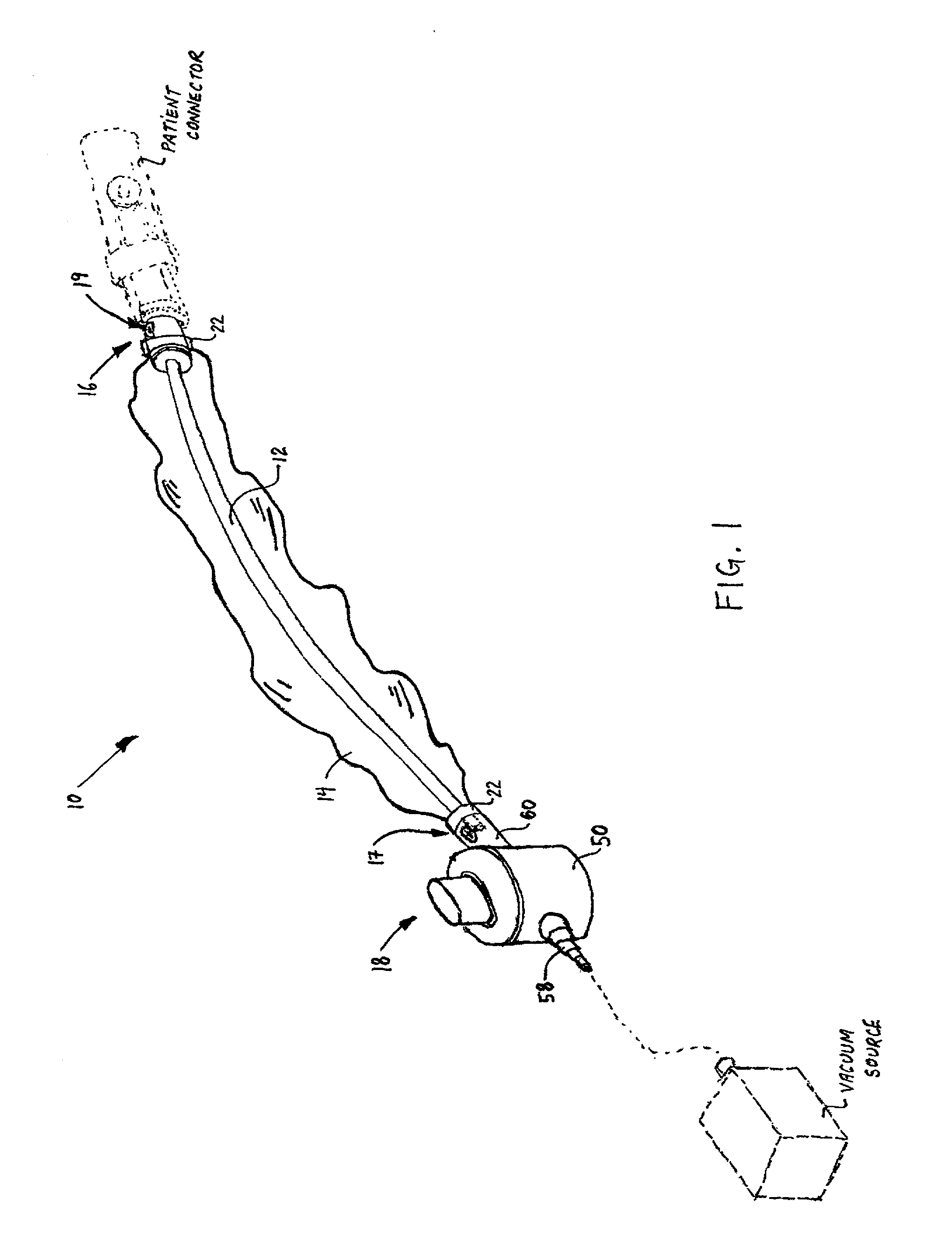 Closed catheter suction system