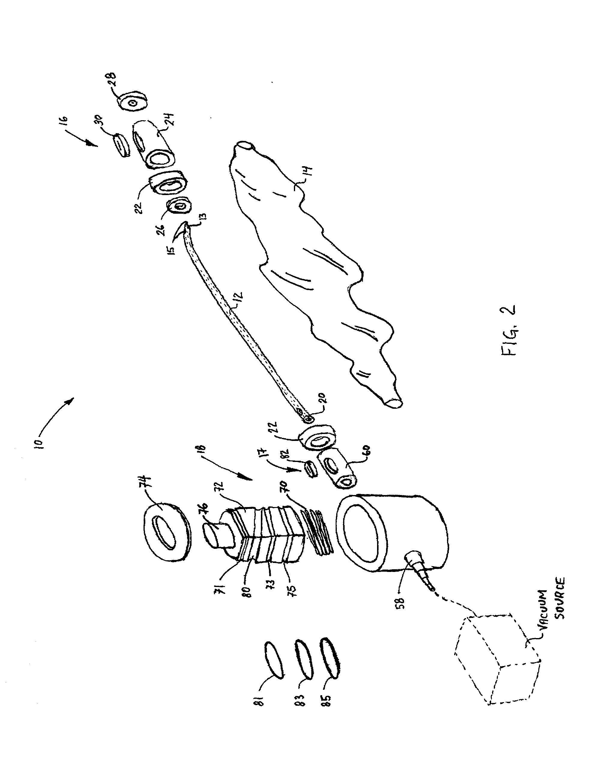 Closed catheter suction system