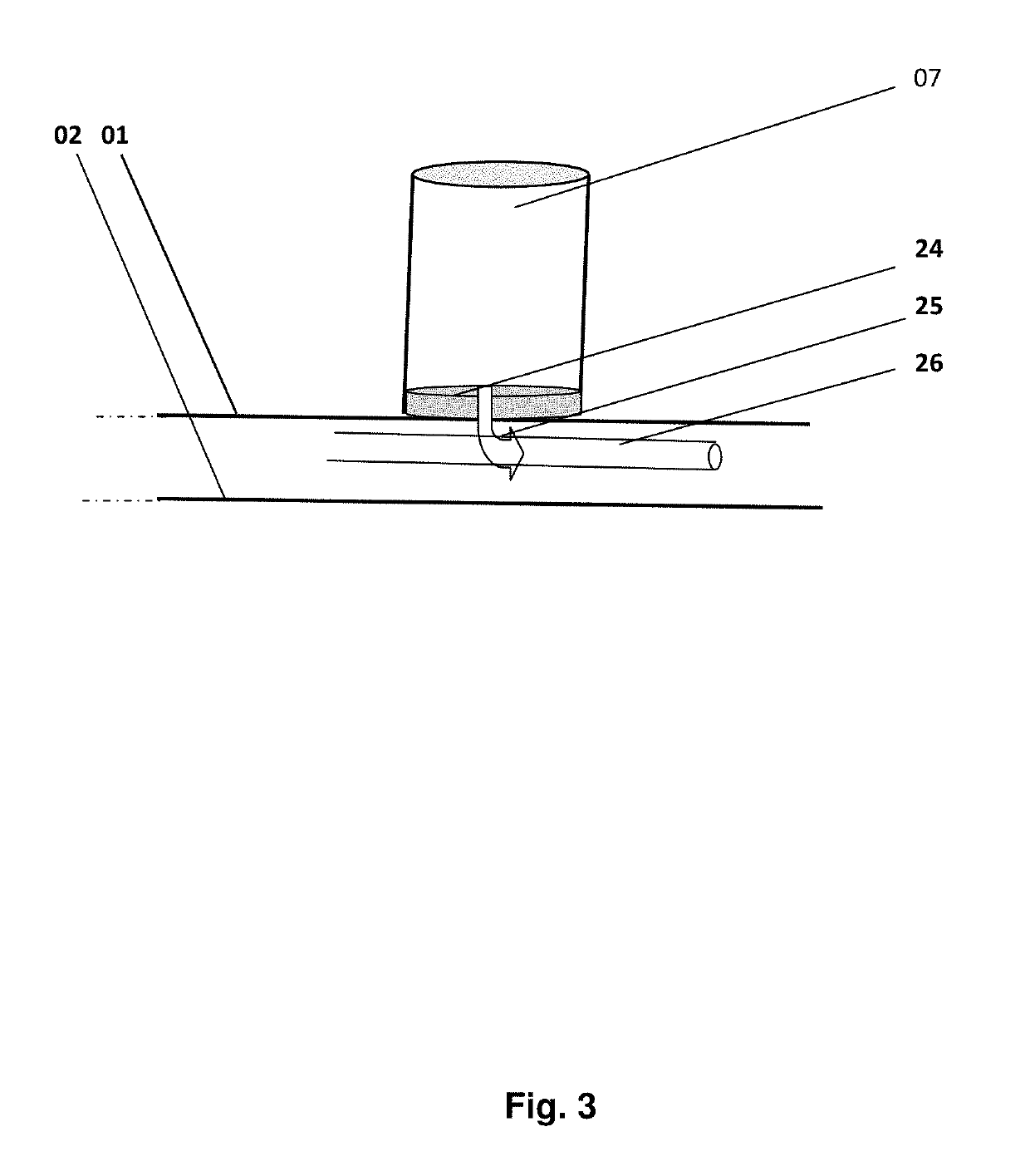 Programmable pressure management support surface