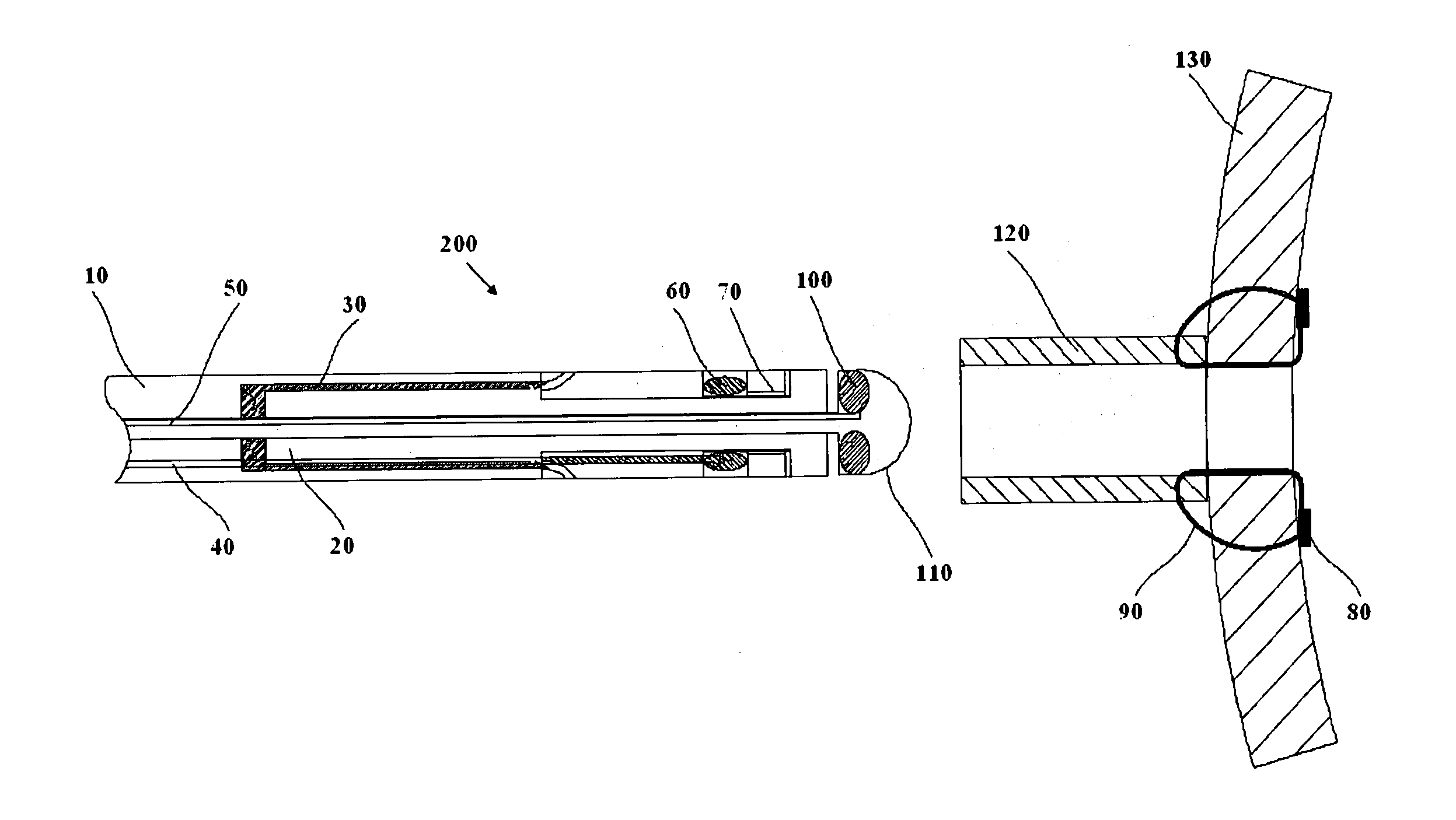 Urethral anastomosis device and method of using the same