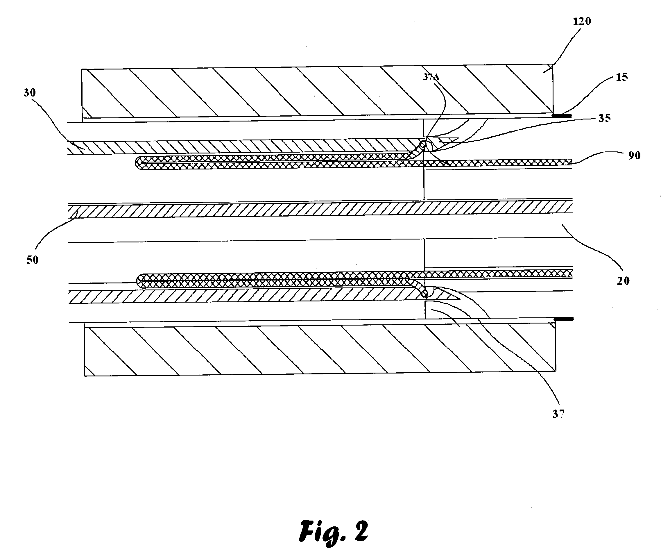 Urethral anastomosis device and method of using the same