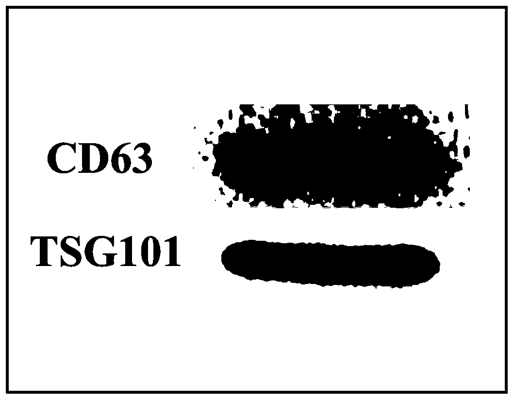 Application of engineered exosome in skin regeneration and repair of diabetic foot ulcer and preparation method of engineered exosome