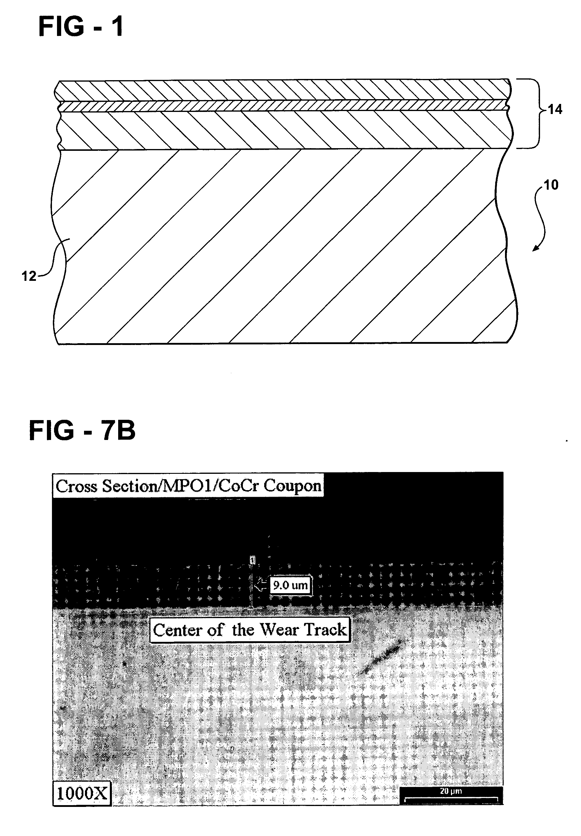 Dual layer diffusion bonded chemical vapor coating for medical implants