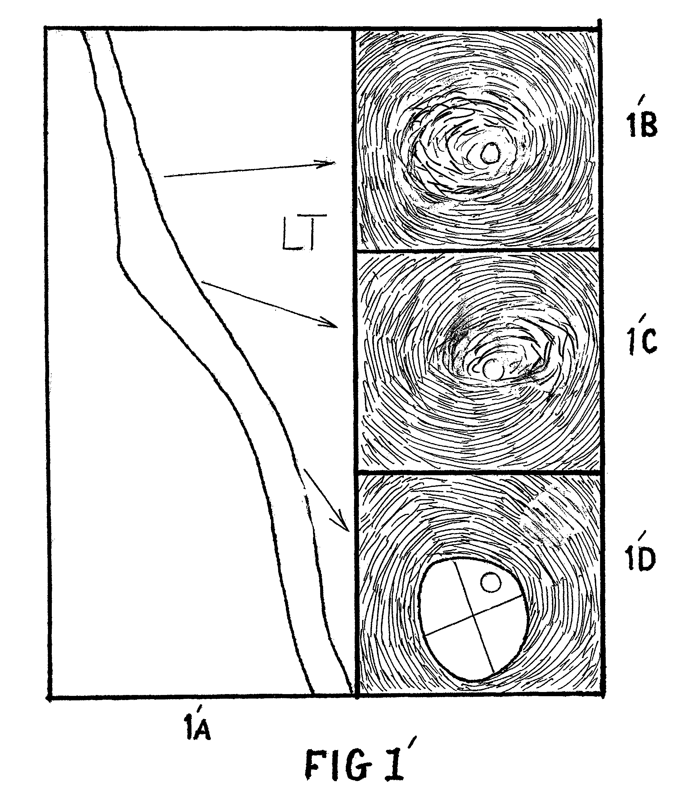 Method of diagnosing and treating CVD