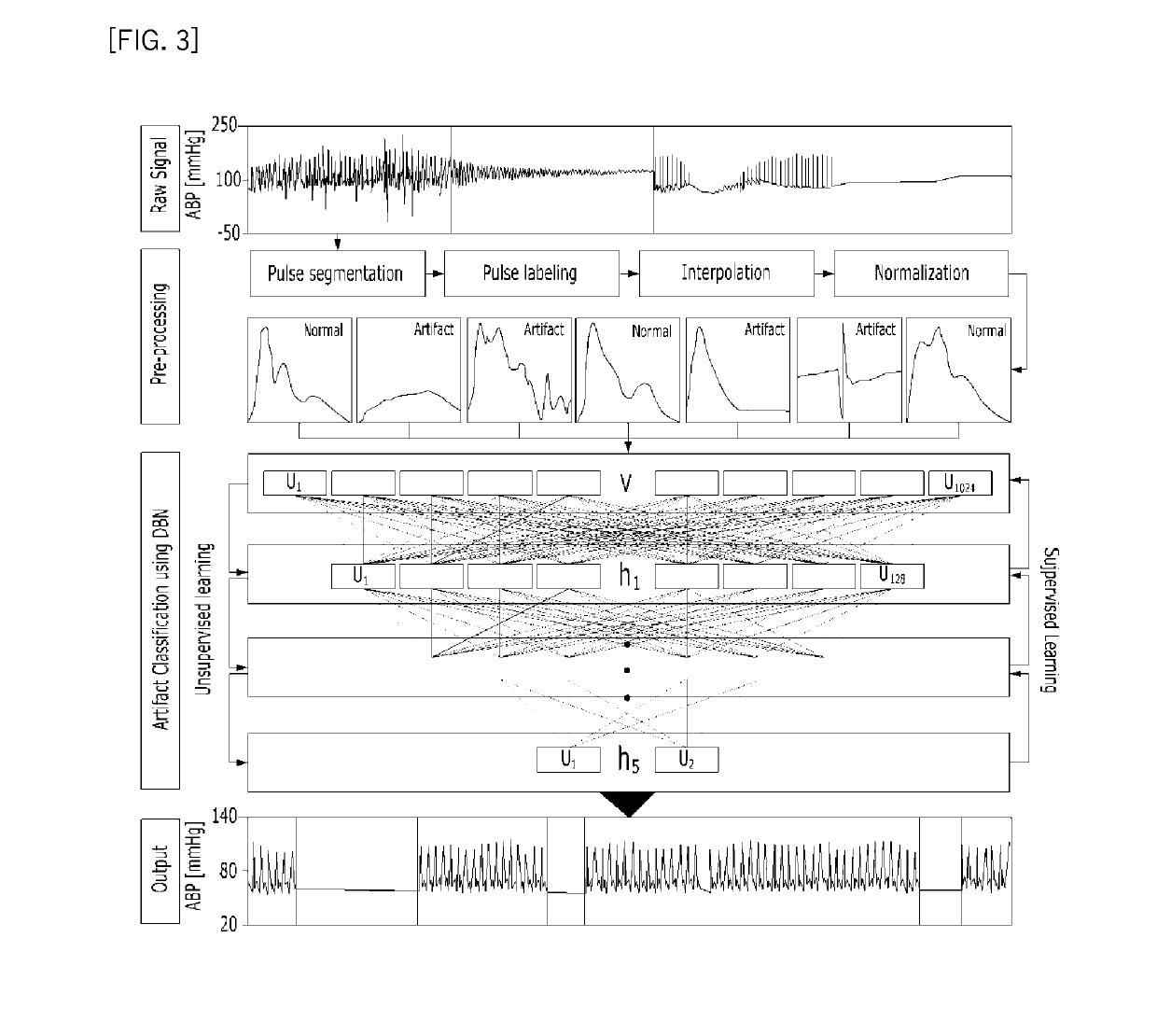 Apparatus and method for detecting artifact of blood pressure signal, and computer readable recording medium storing the method