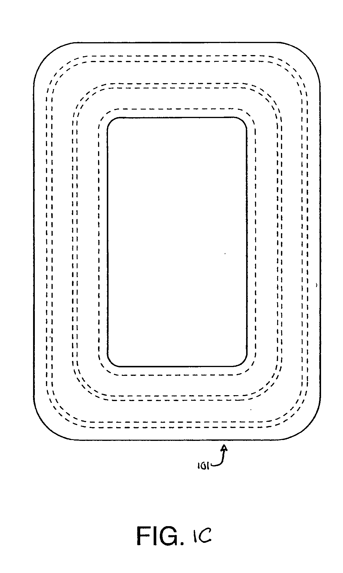 Container having a rim or other feature encapsulated by or formed from injection-molded material