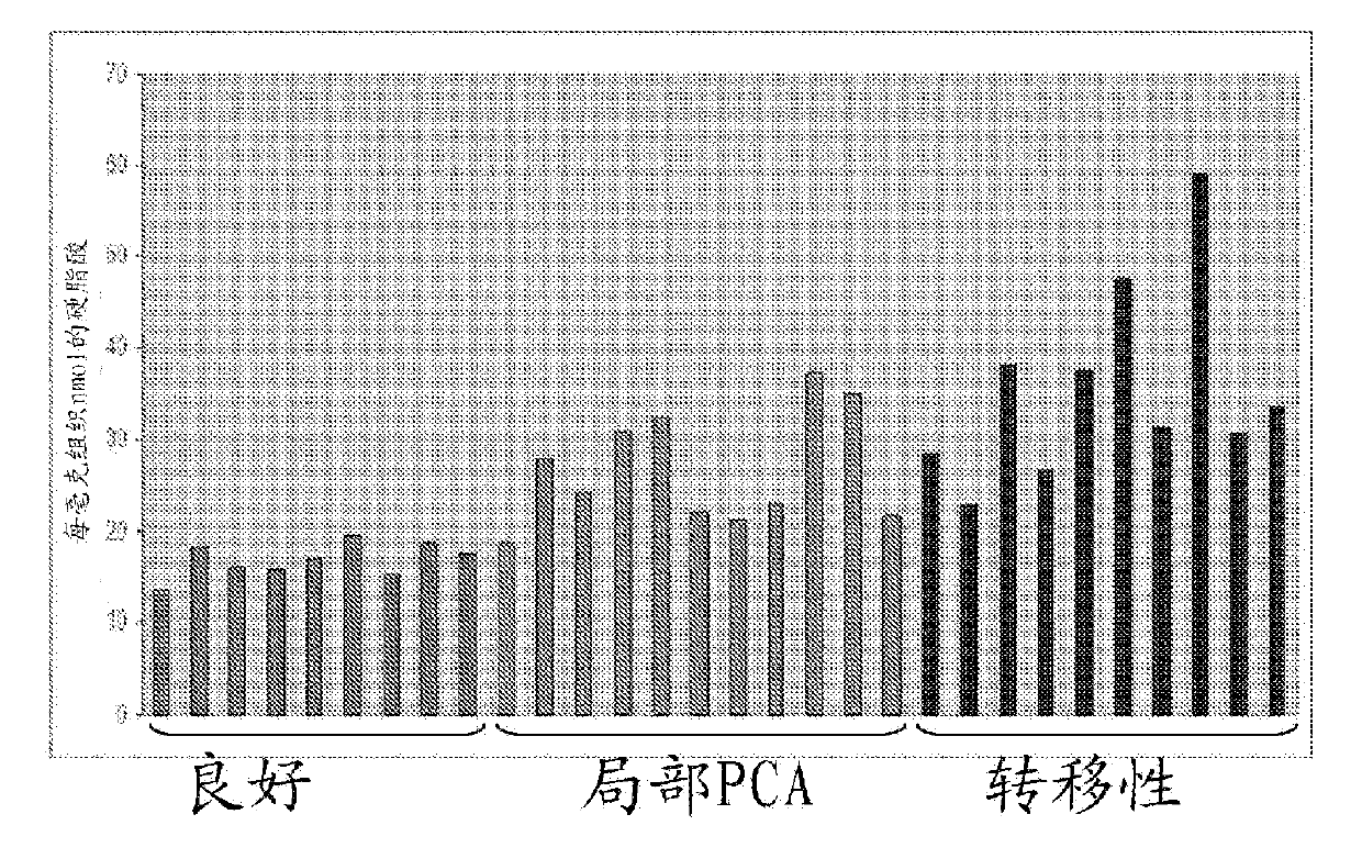 Metabolomic profiling of prostate cancer