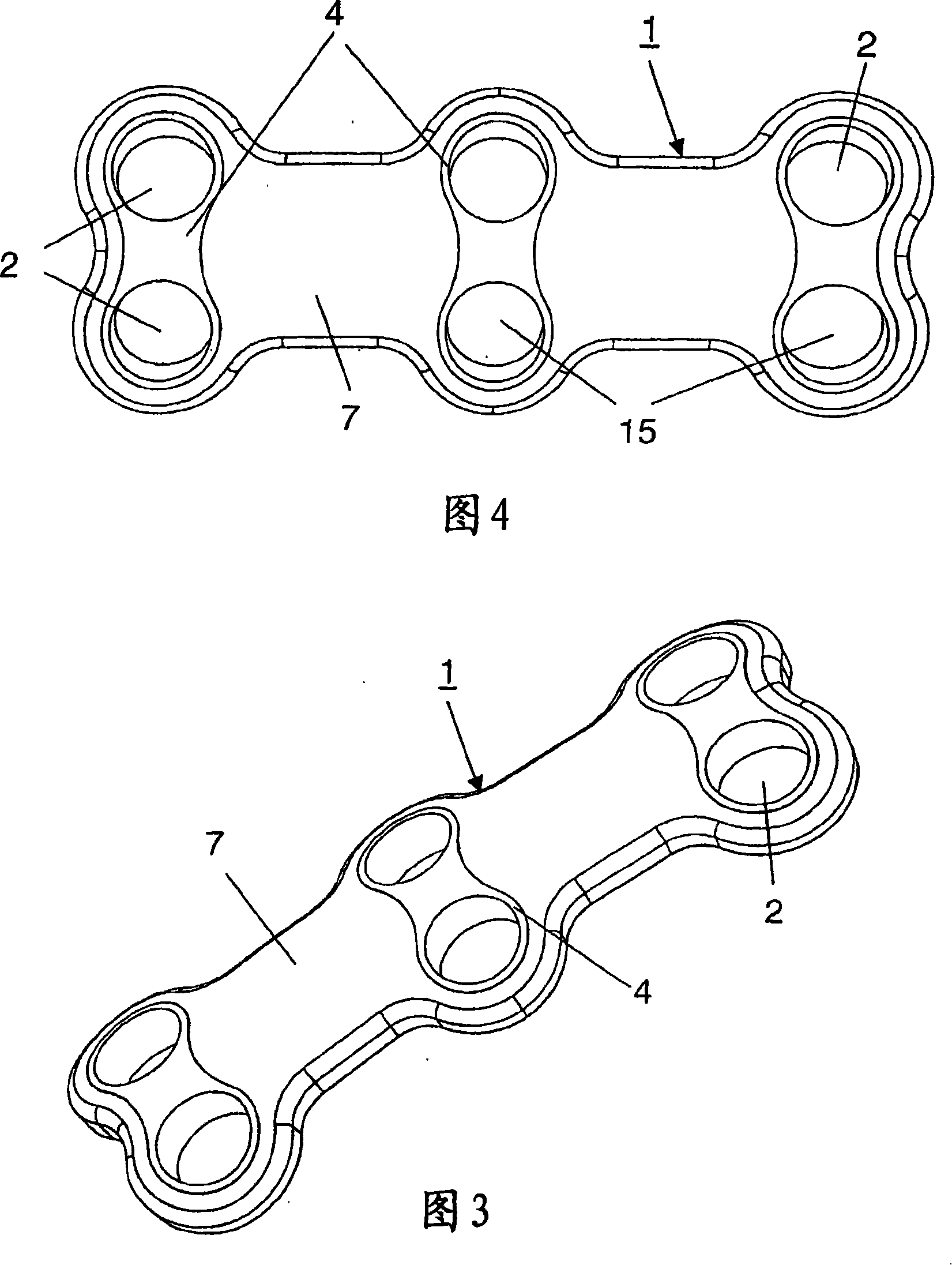 Implant for fixing bones