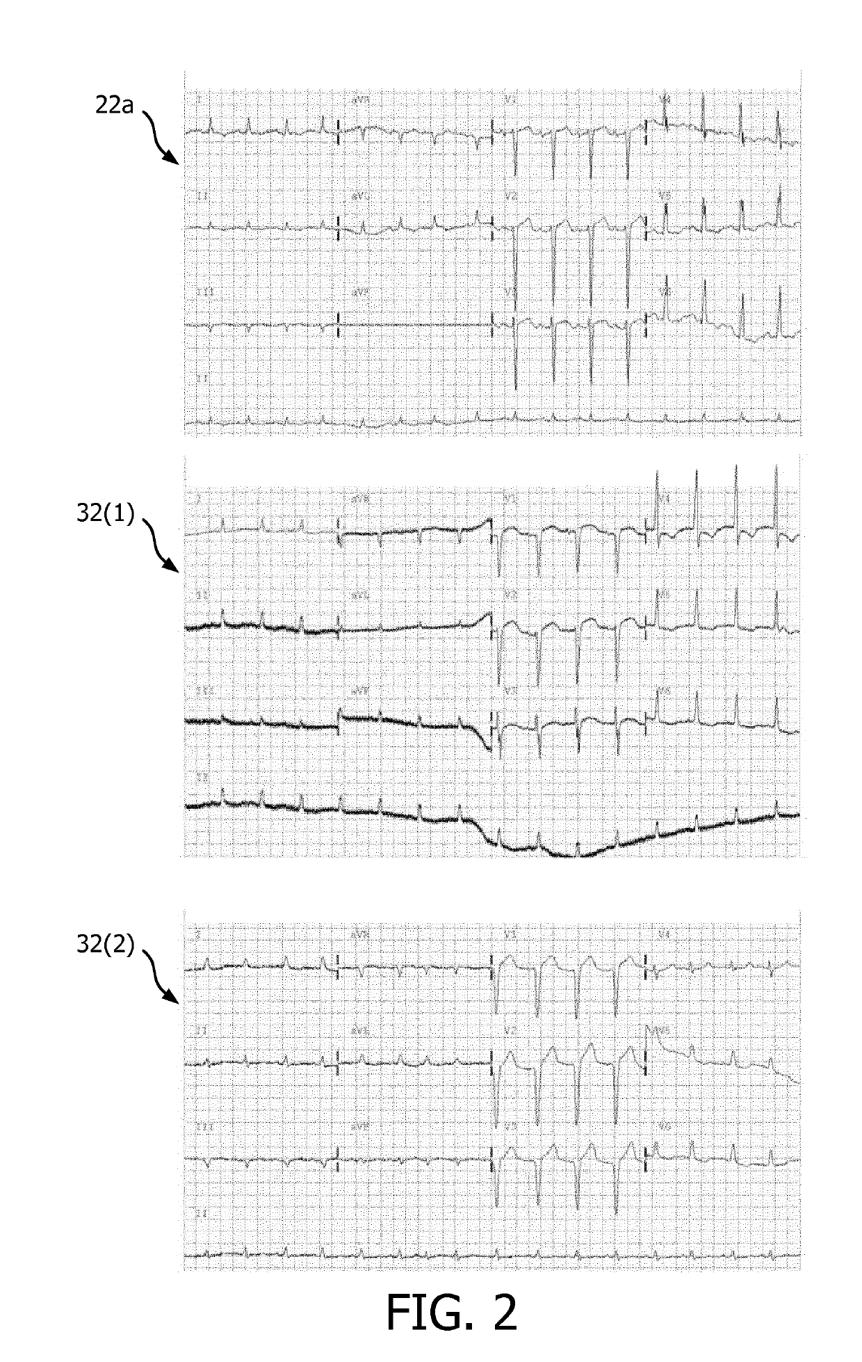 ECG training and skill enhancement