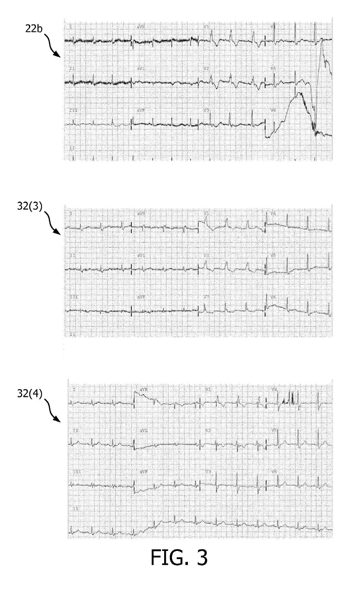 ECG training and skill enhancement