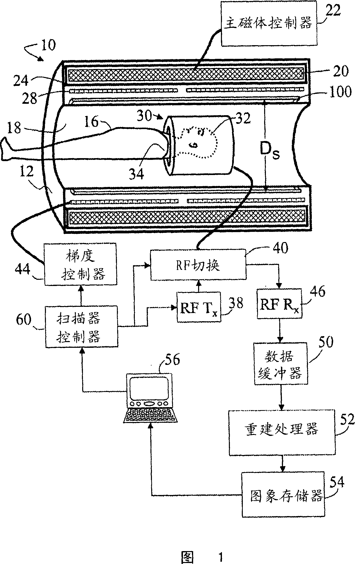 Electromagnetic shielding for high field MRI coils