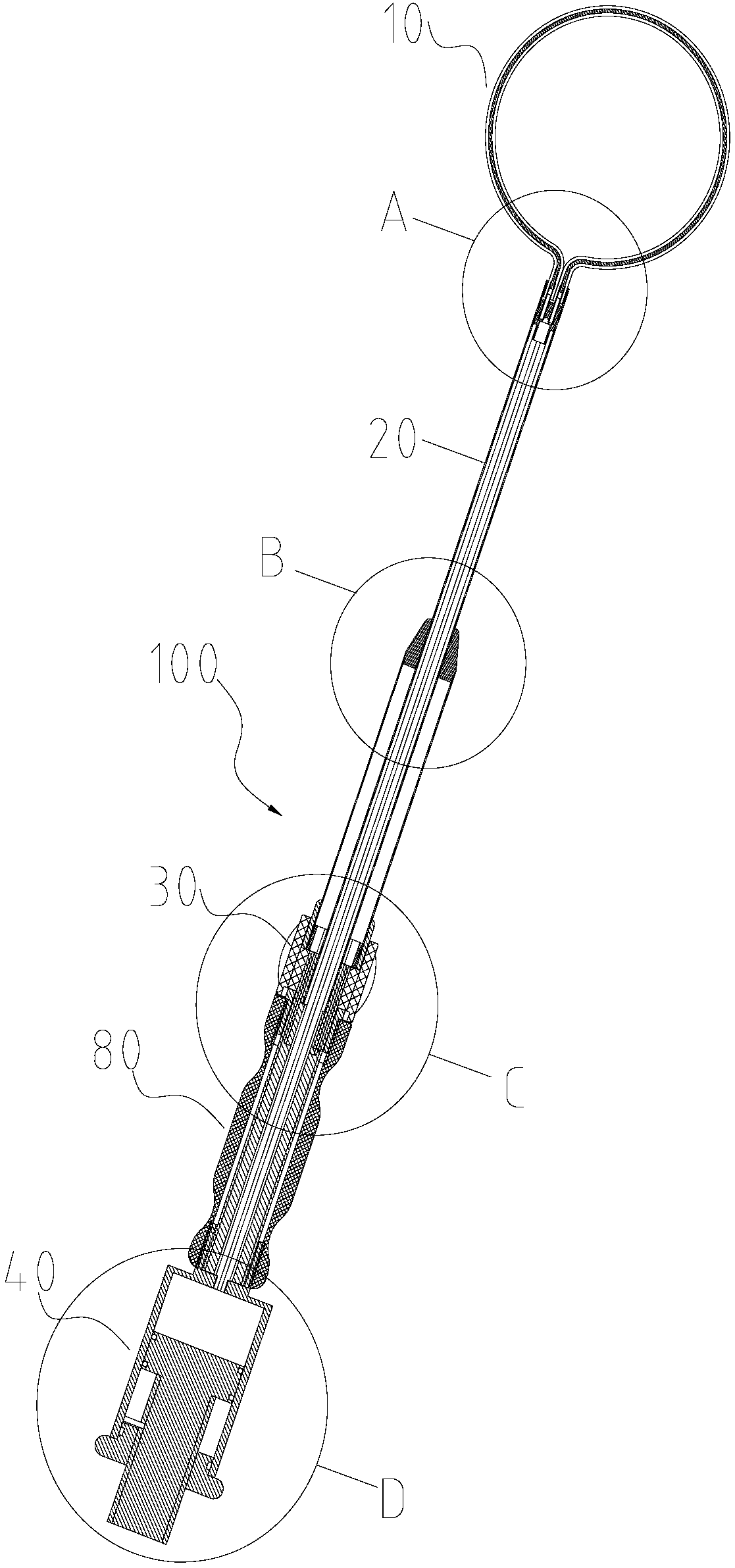 Single-hole laparoscopic spleen retractor