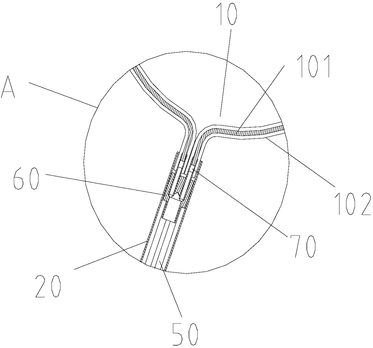 Single-hole laparoscopic spleen retractor