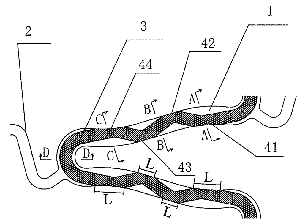 Intravascular stent with medicament carrying groove