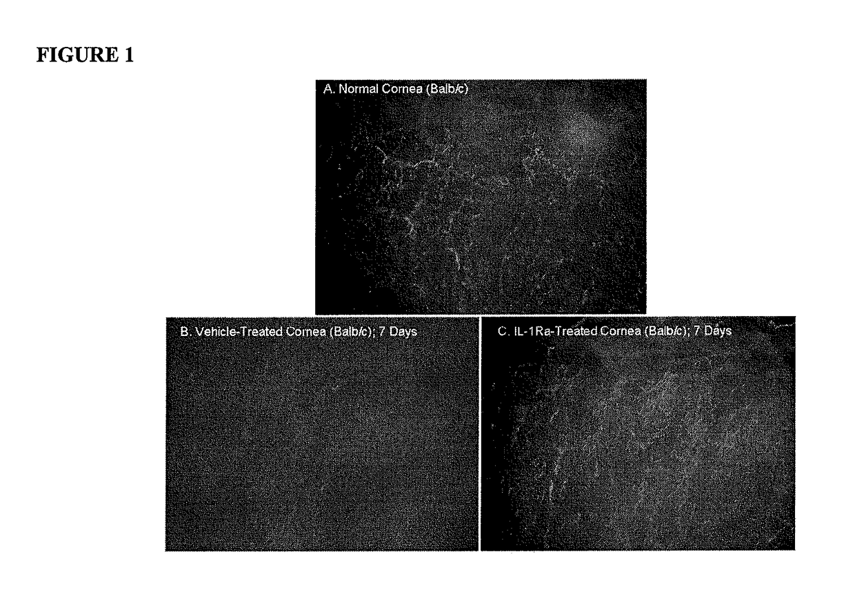 Methods for reducing corneal nerves damage, corneal lymphangiogenesis or immunity to corneal antigens in dry-eye associated ocular surface diseases by IL-1Ra