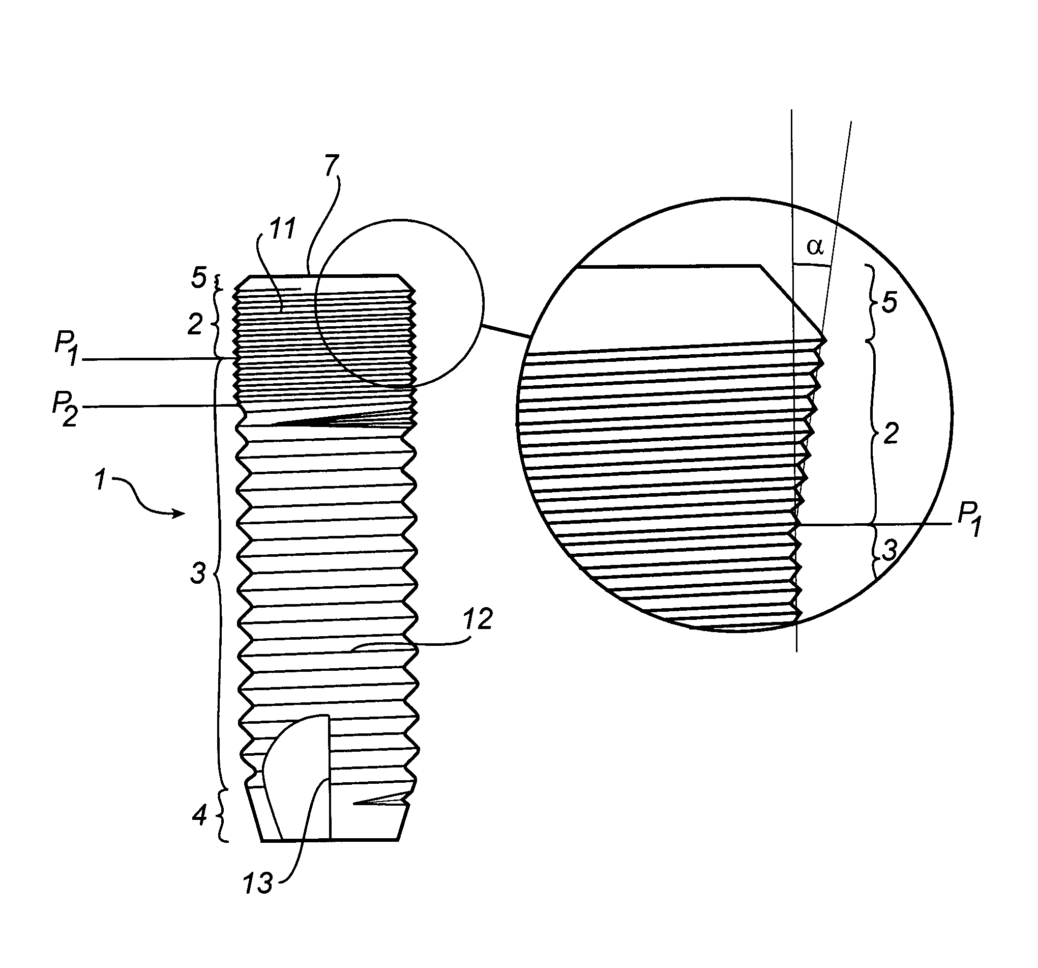 Implant, arrangement comprising an implant, and method for inserting said implant in bone tissue