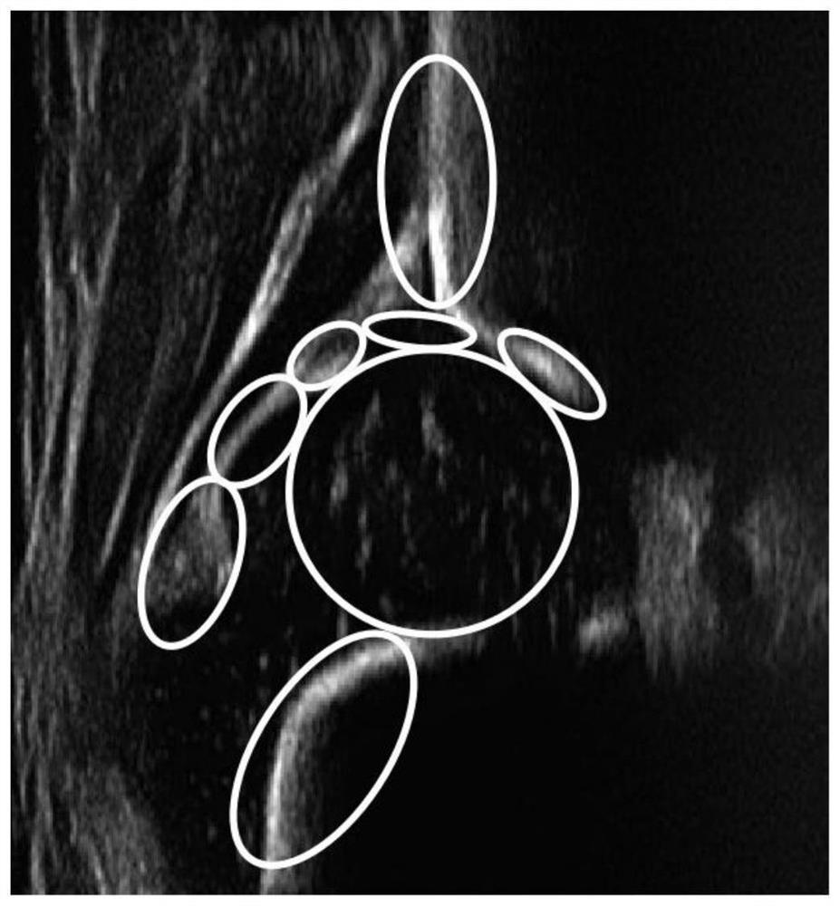 Hip joint standard ultrasonic image acquisition method based on Graf ultrasonic technology and intelligent system