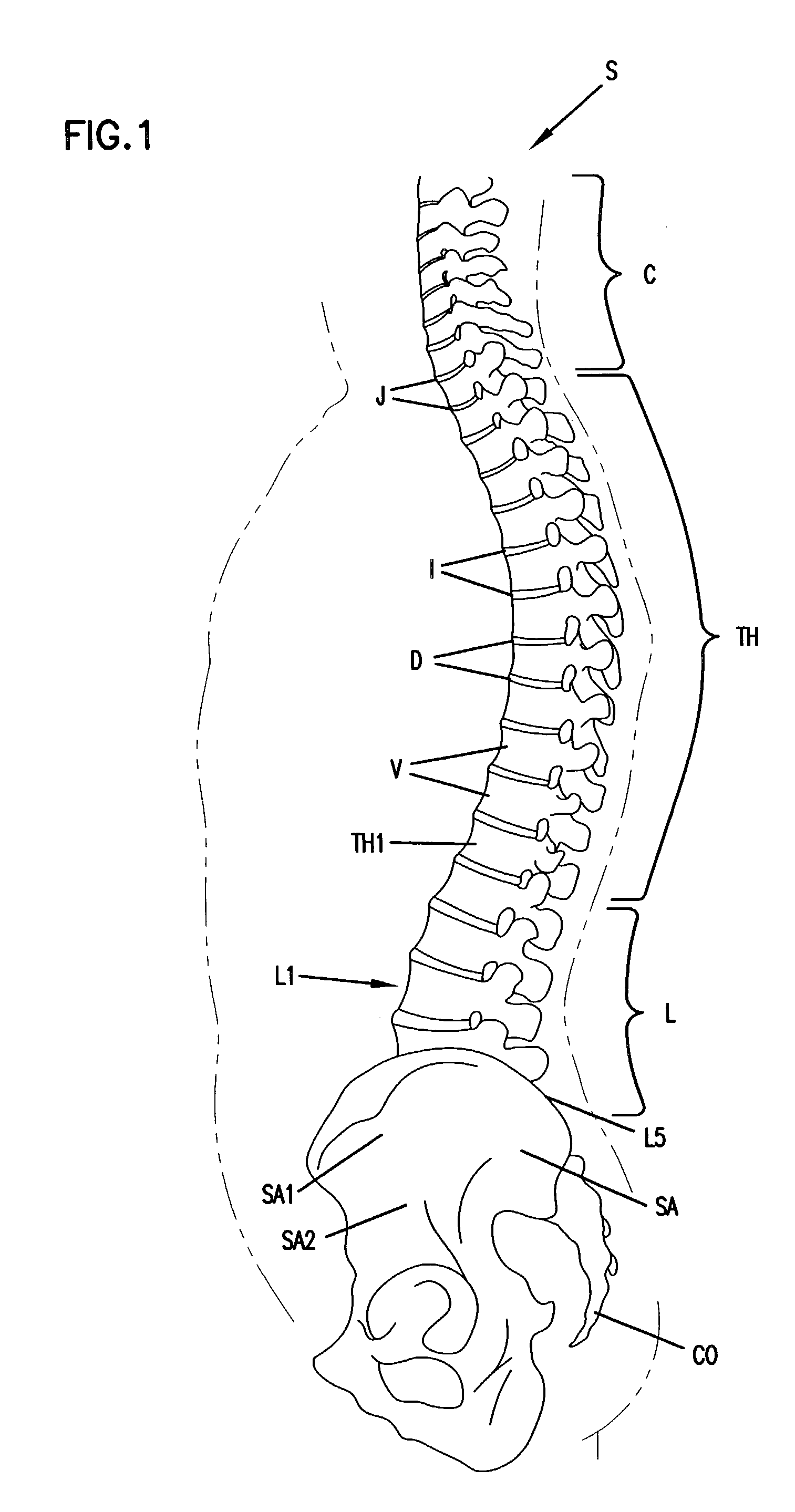 Spinal fixation device and method