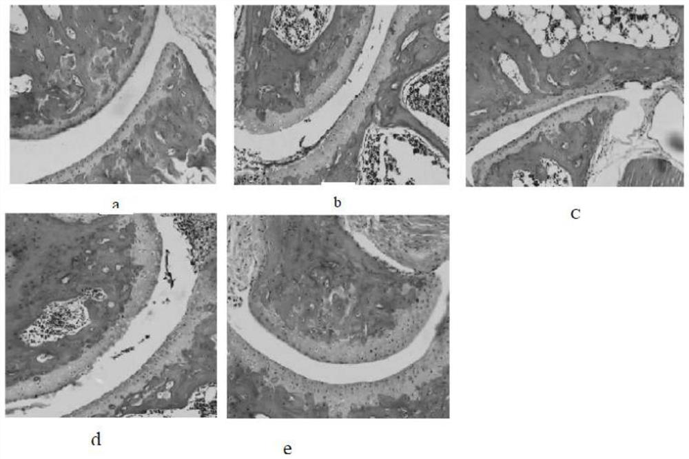 Application of total flavonoids of clover in preparation of medicine for treating rheumatoid arthritis