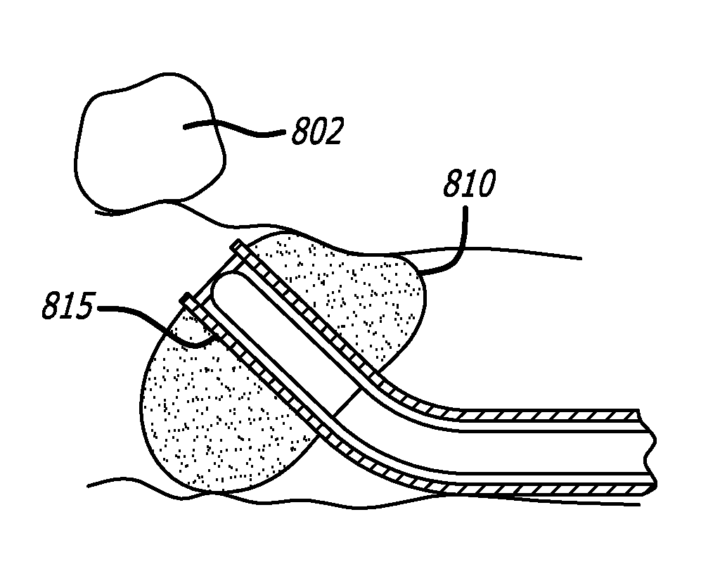 Directional Anchoring Mechanism, Method And Applications Thereof