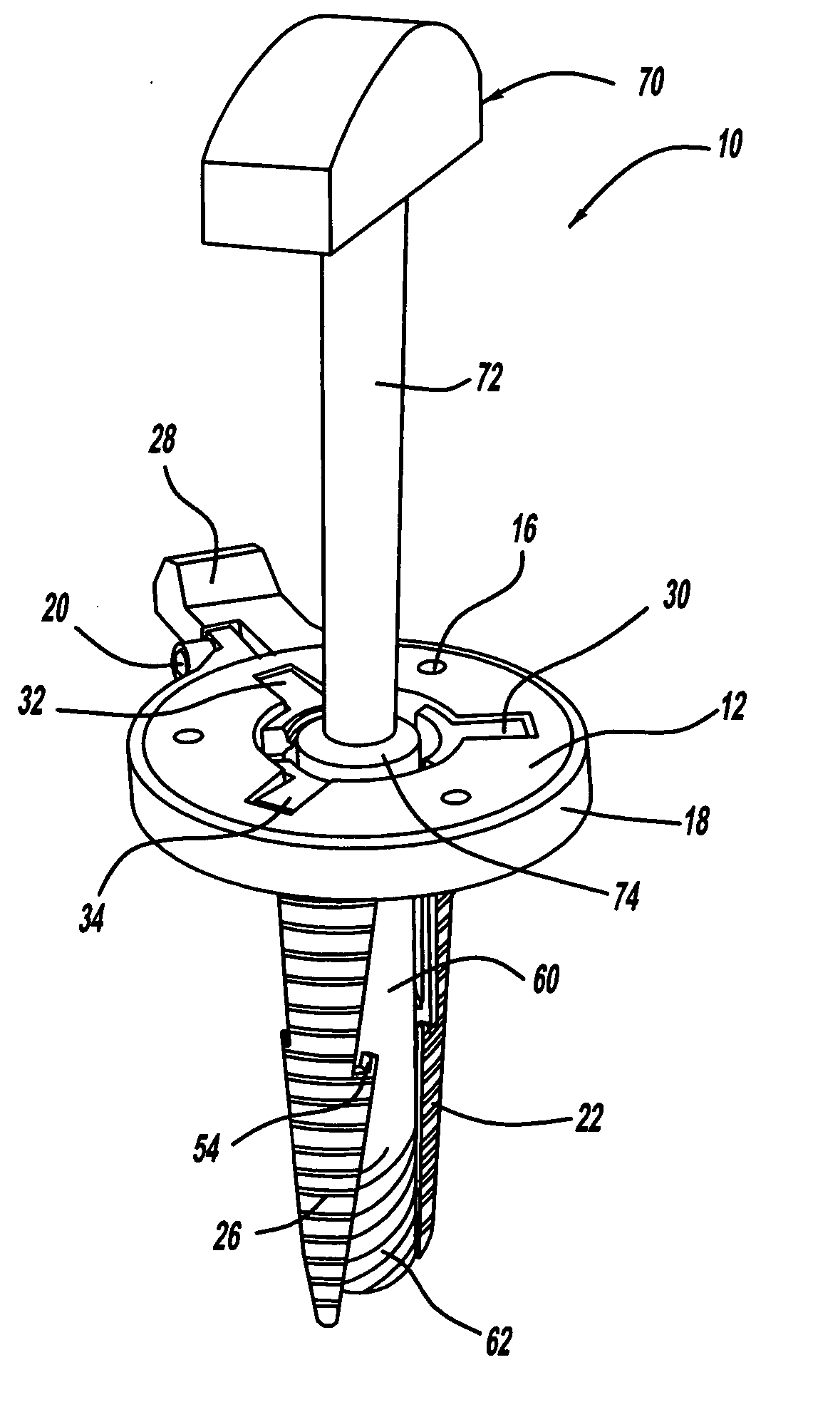 Minimally invasive surgical access device