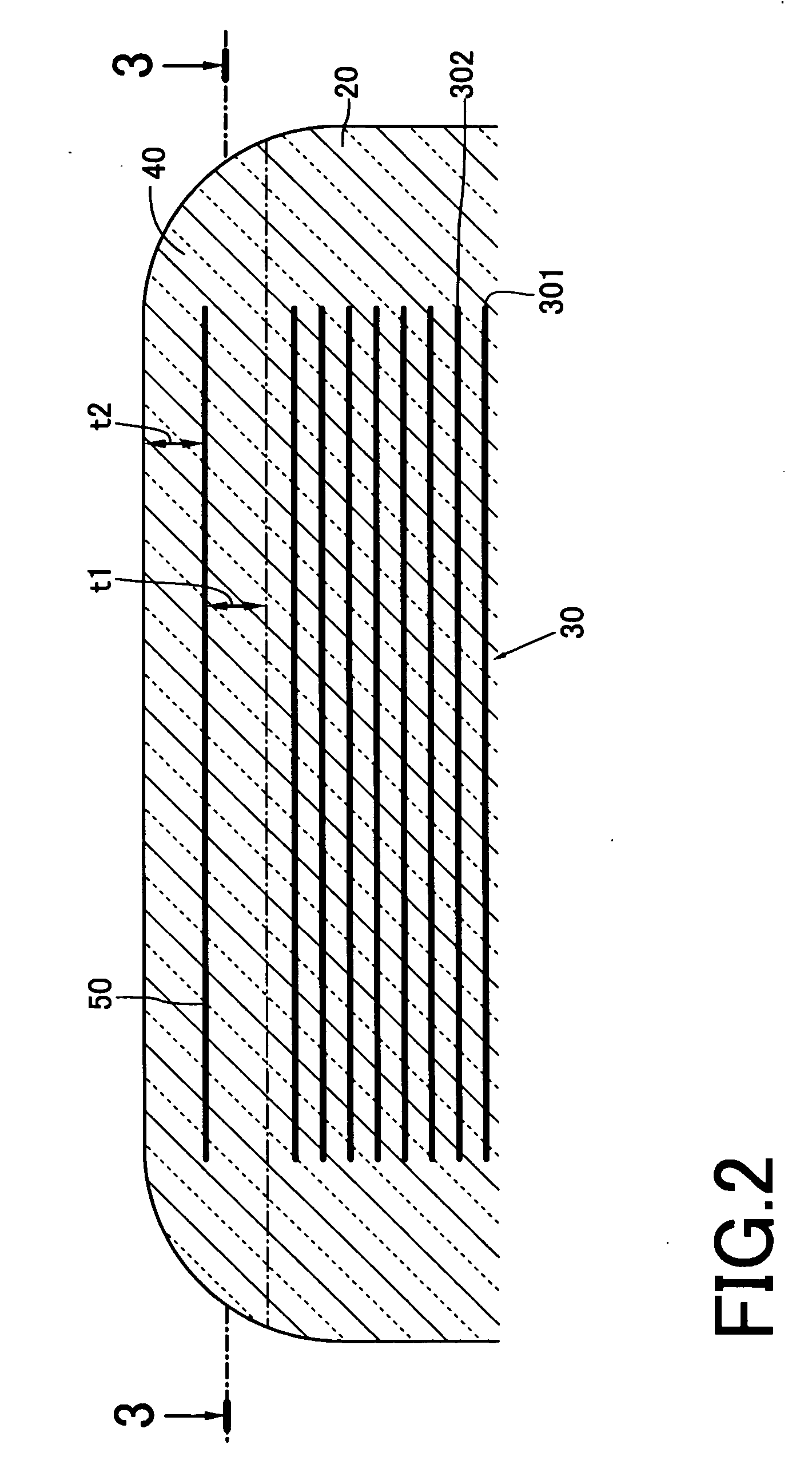 Laminated ceramic electronic component