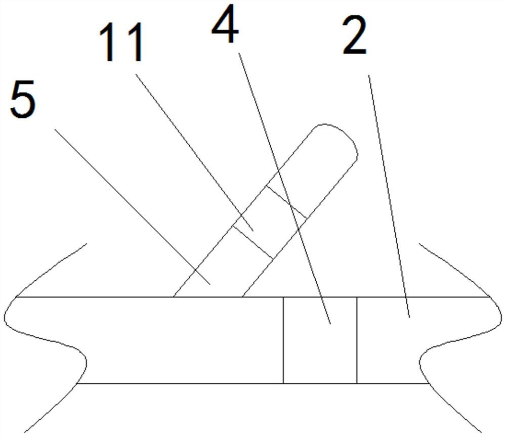 Diabetic prevention and treatment bracelet with adjustable size and management system thereof