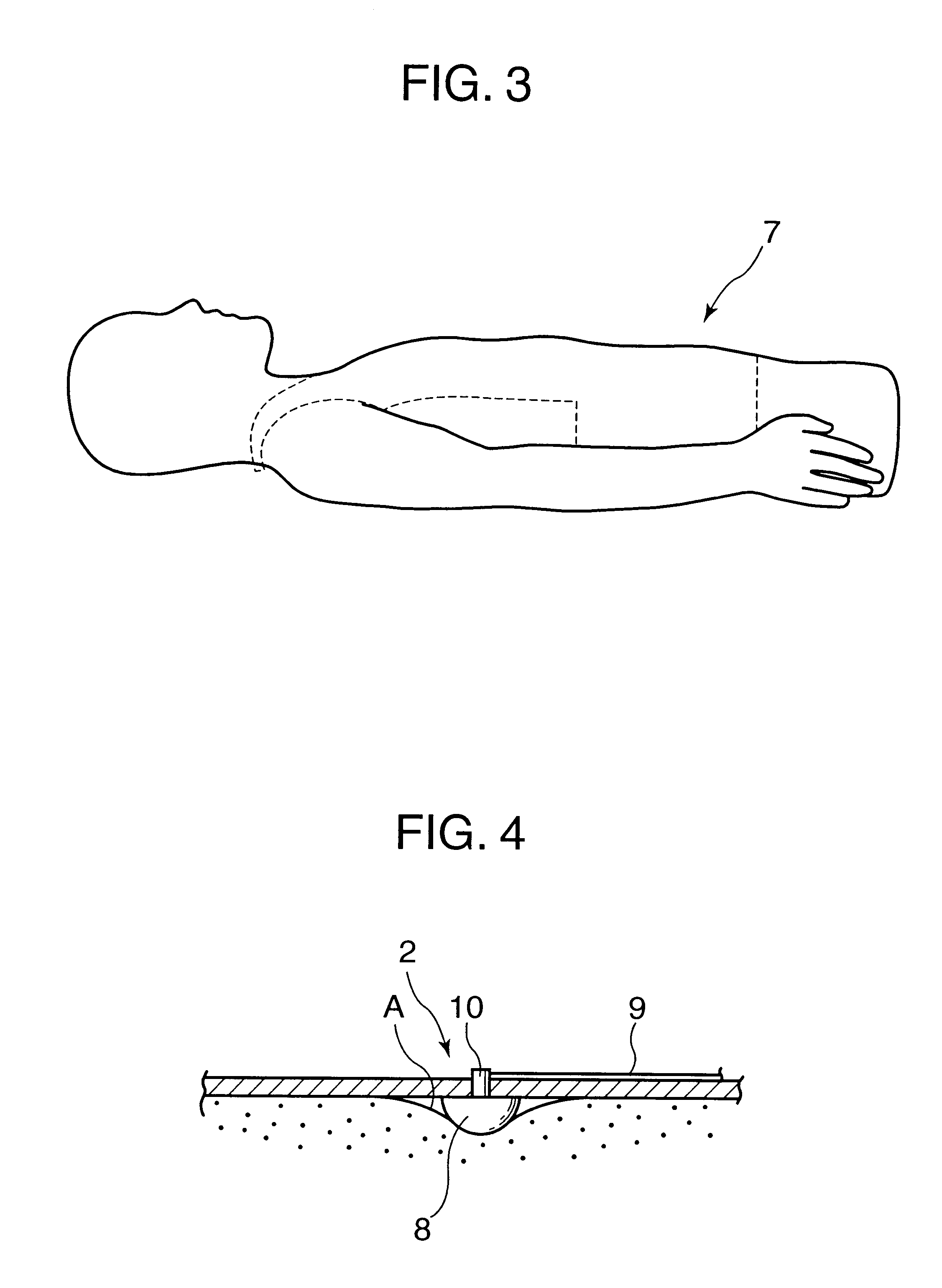 EKG recording electrode device