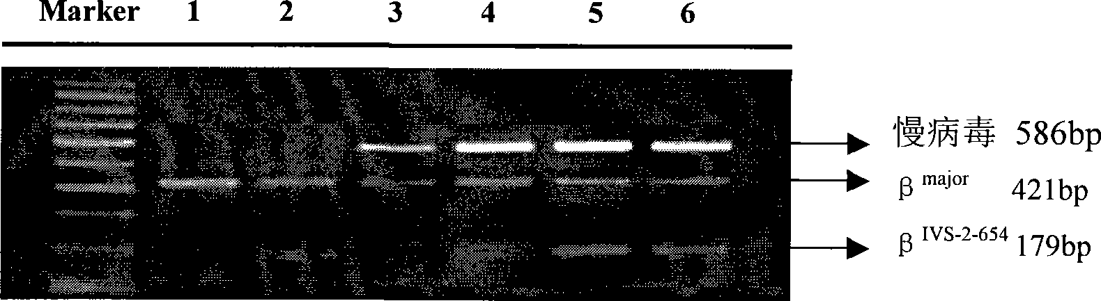 Method for preparing beta&lt;IVS-II-654&gt; transgene mouse model carrying human beta globin gene