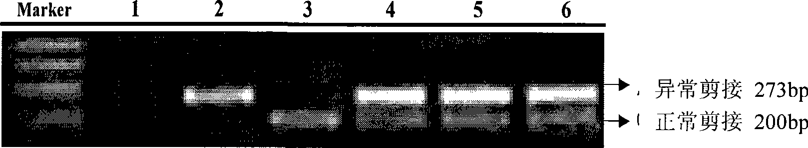 Method for preparing beta&lt;IVS-II-654&gt; transgene mouse model carrying human beta globin gene