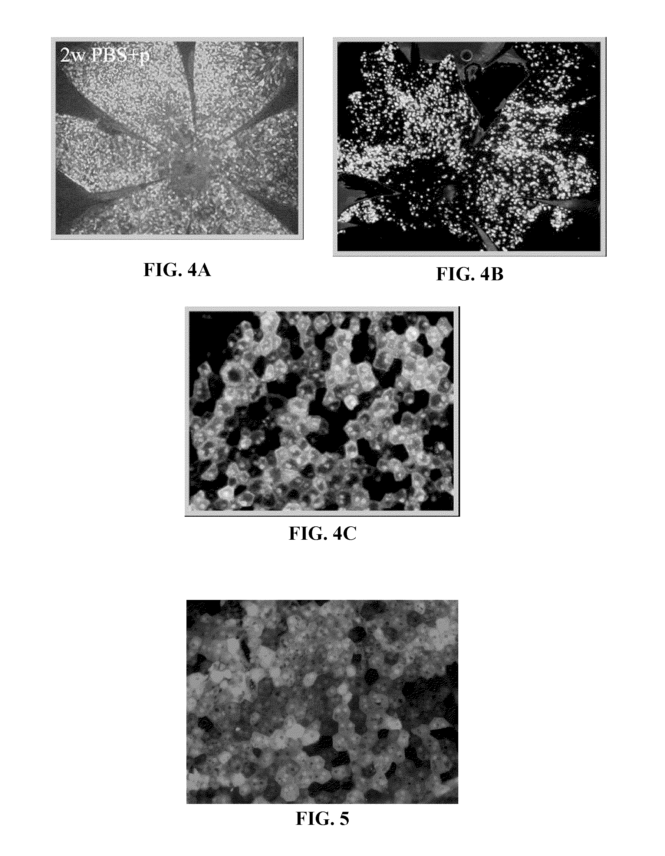 Treatment of diseases characterized by inflammation