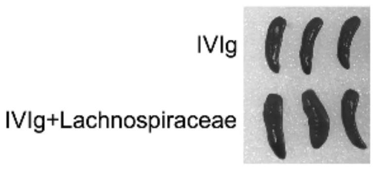 Combination medicine of hispiraceae bacteria and human immune globulin for injection