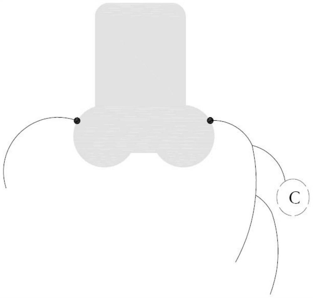 Coronary Artery Segmentation Method Fused with Dual Source CT Data