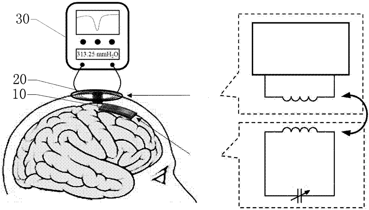 Intracranial pressure sensor, detection equipment and making method