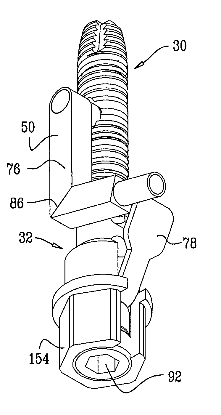 Implants, tools, and methods for sinus lift and lateral ridge augmentation