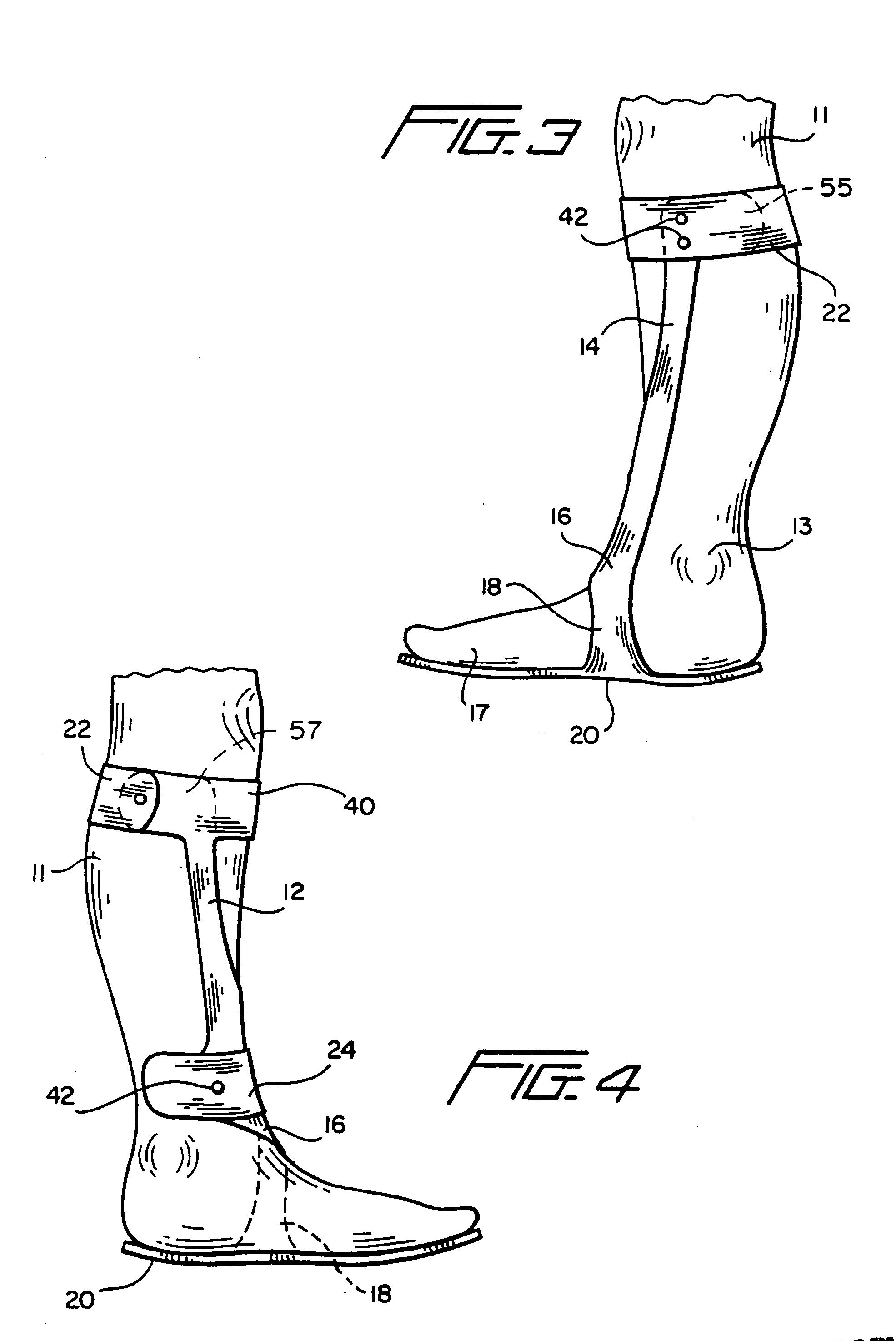 Ankle-foot orthosis