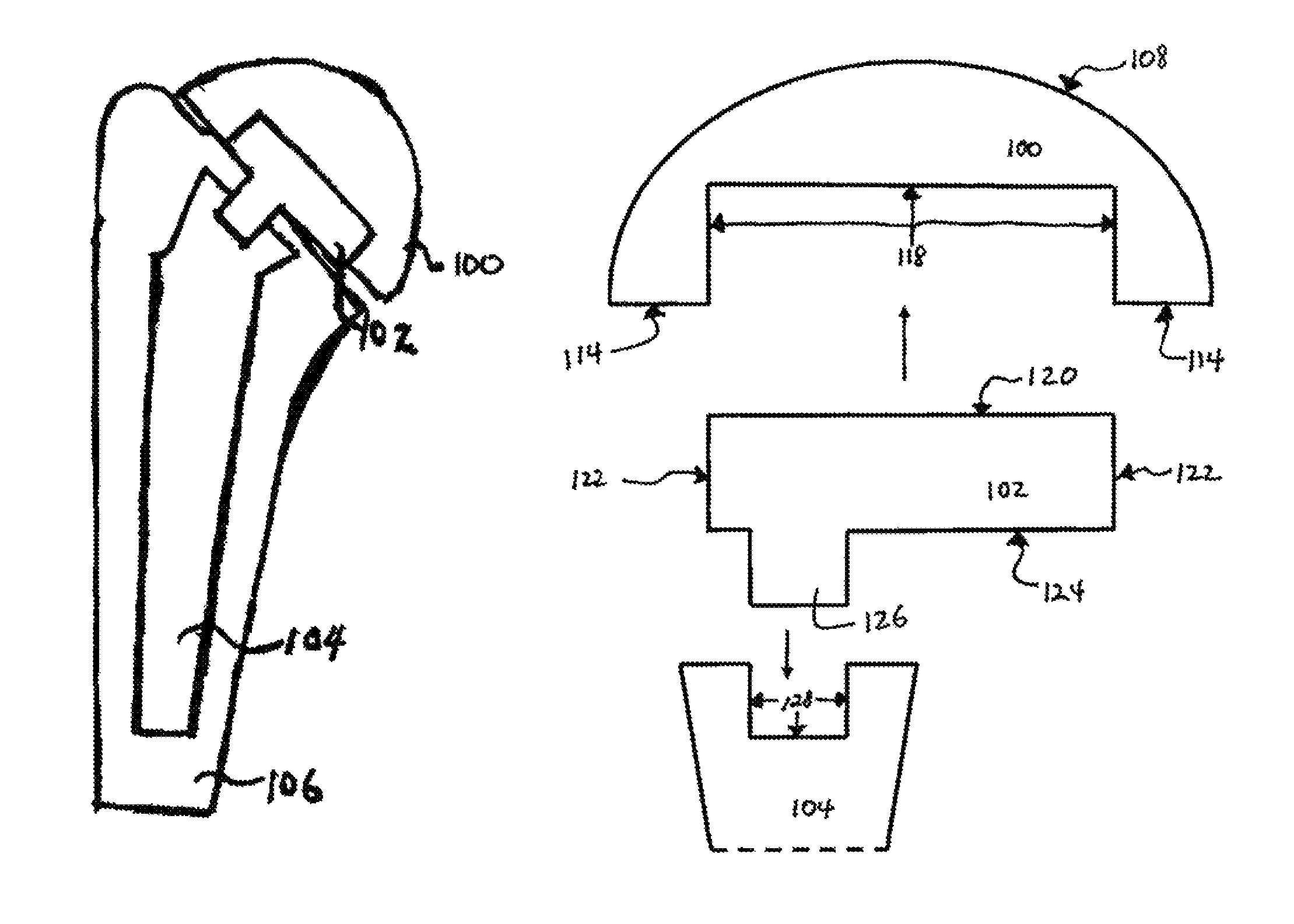 Humeral joint replacement component