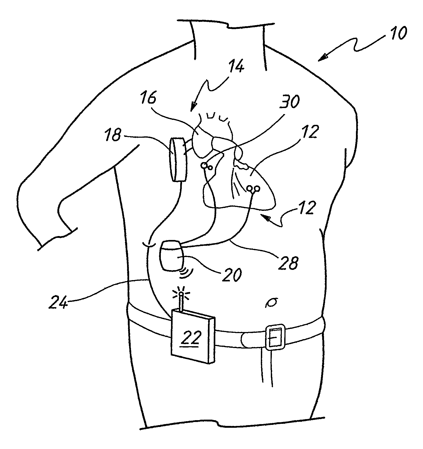 Synchronization control system