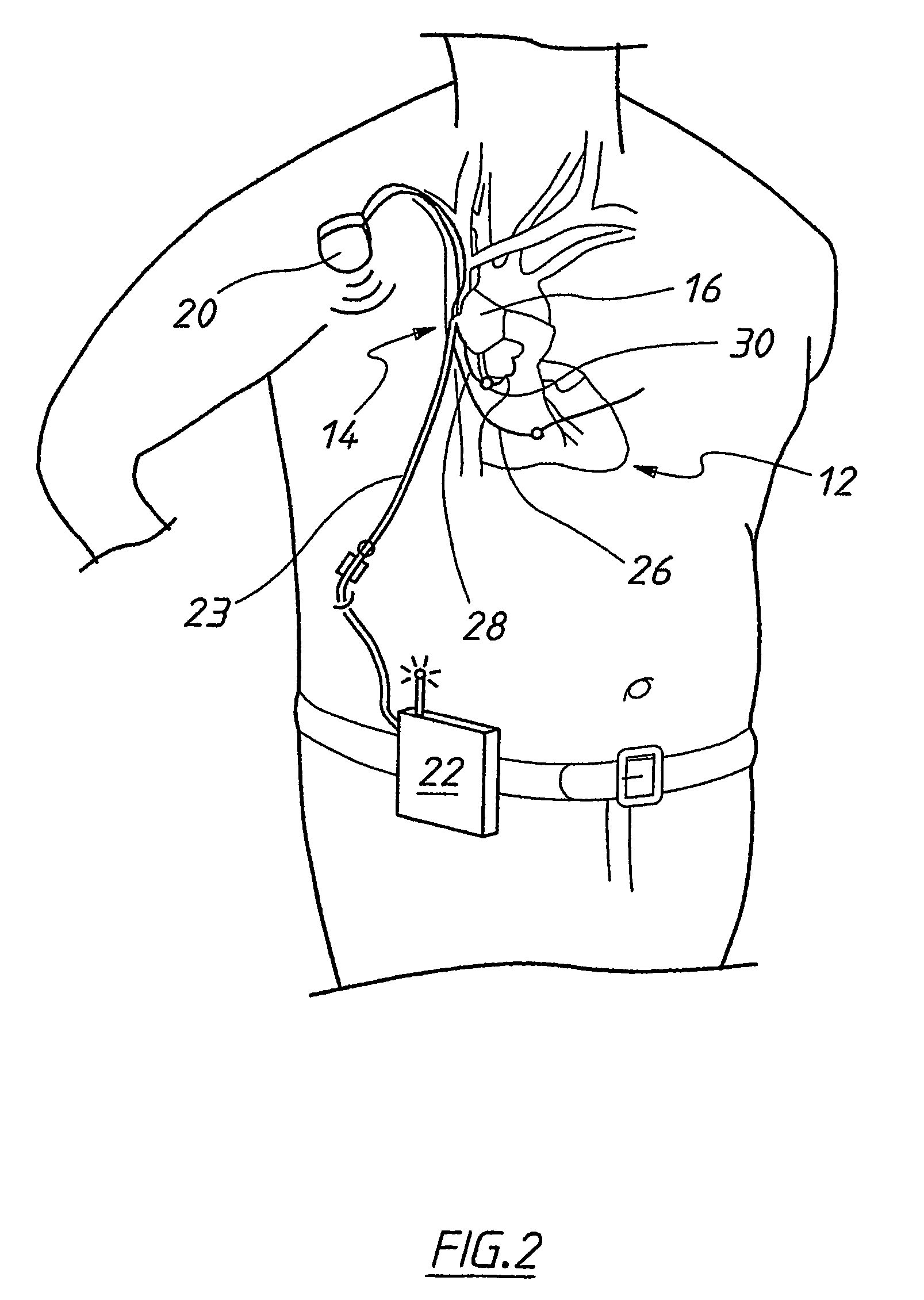 Synchronization control system