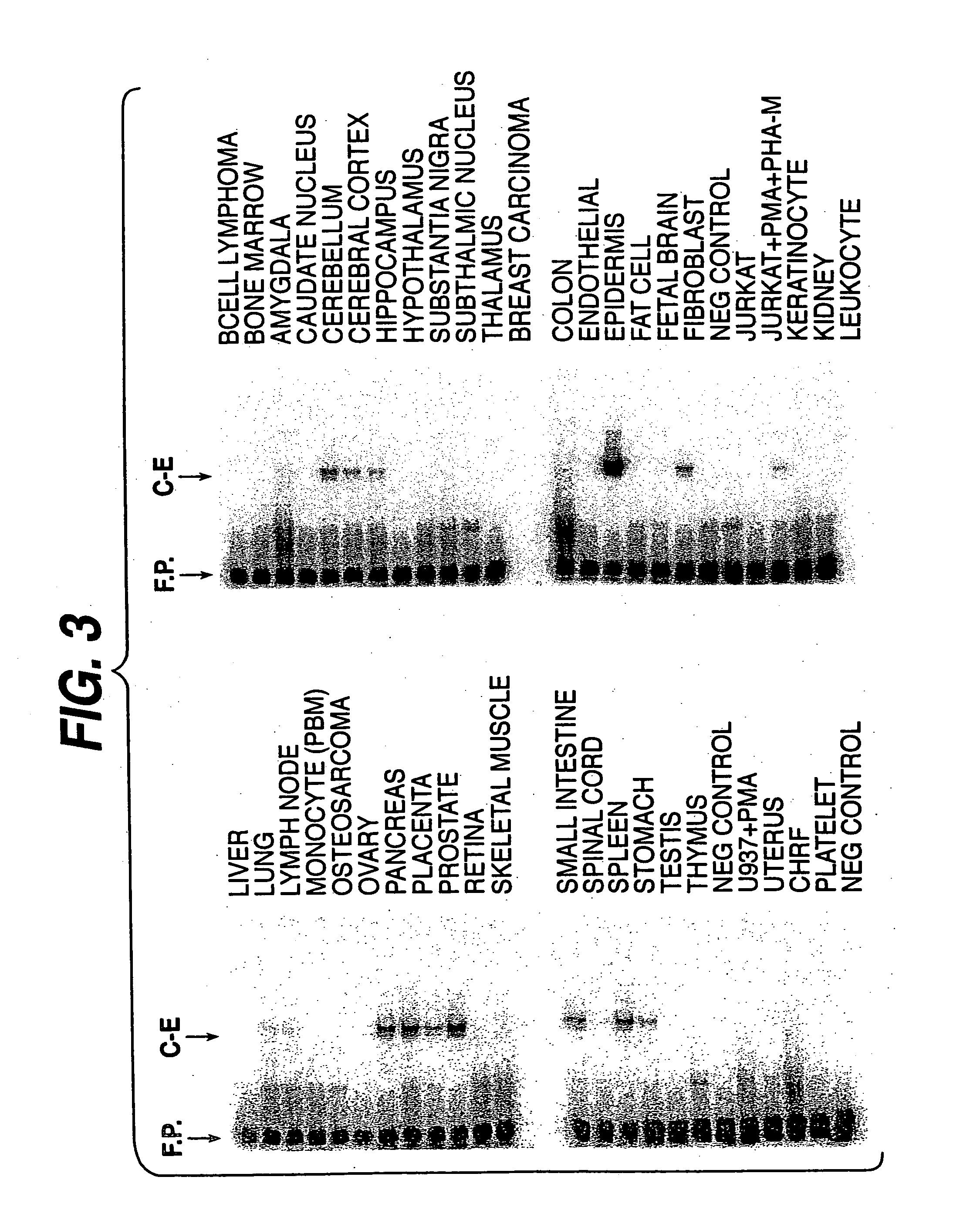 DNA encoding the human serine protease C-E