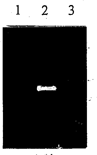 Recombinant adenovirus for preventing baby's diarrhea