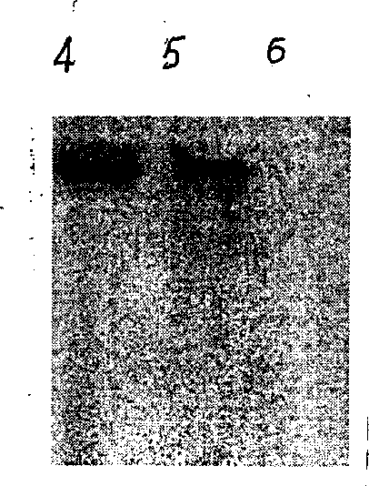 Recombinant adenovirus for preventing baby's diarrhea