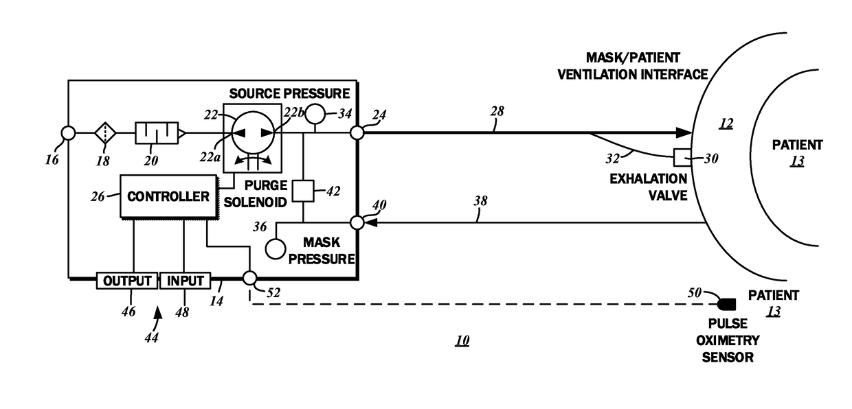 Continuous positive airway pressure therapy auto-titration